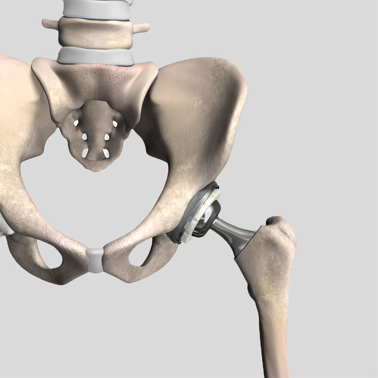Hip Doctors West University Place Texas | Catherine Cahill MD