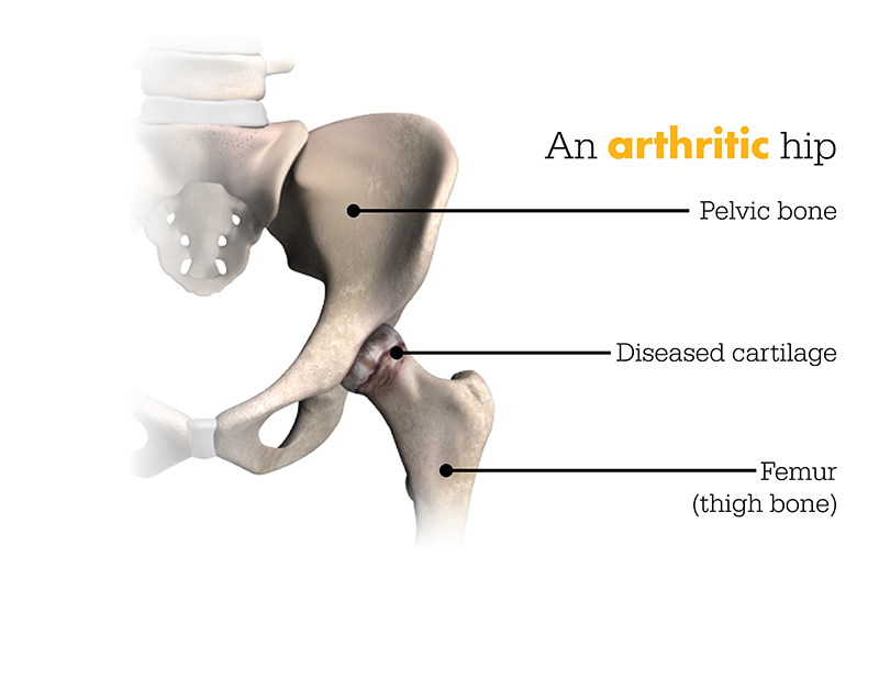 Hip Specialist West University Place | Catherine Cahill MD