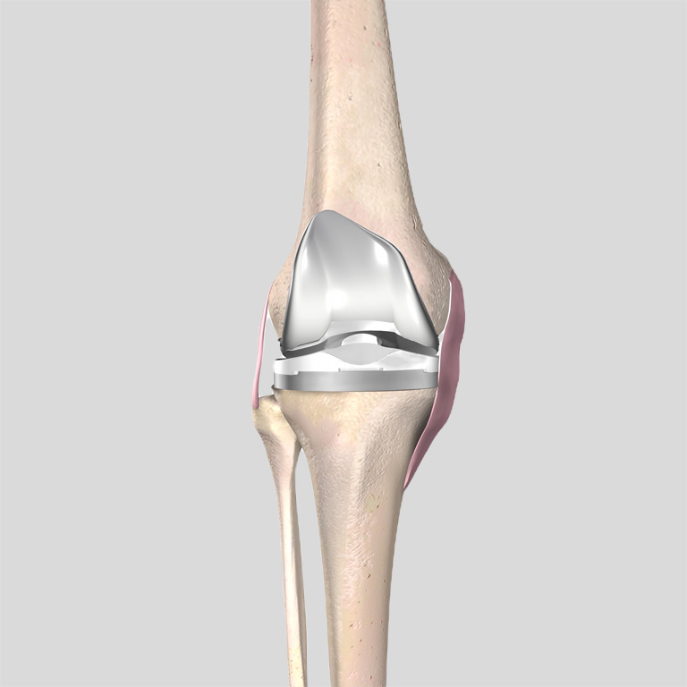 Knee Doctor in Northwest Houston, TX with Catherine Cahill MD.