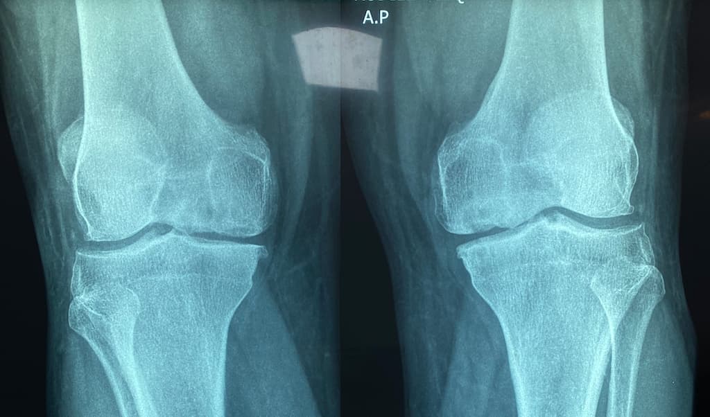 Knee Specialist in Northwest Houston, TX with Catherine Cahill MD.