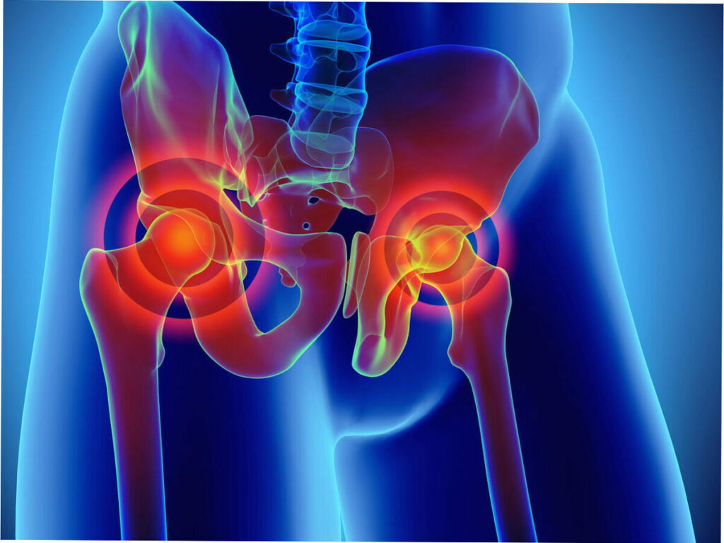 When Should You See a Knee Replacement Specialist in Houston?