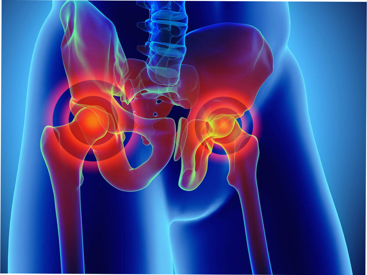 When Should You See a Knee Replacement Specialist in Houston?